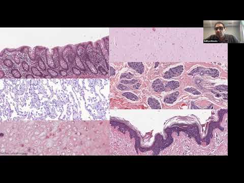 YouTube video eI1w7kmhyJI thumbnail